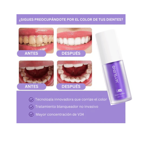 Blanqueador Dental V34 ⭐⭐⭐⭐⭐ JAYSUING